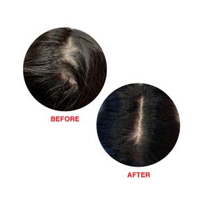 سرم مو ضد ریزش مناسب انواع مو هیرتامین 60 میل	